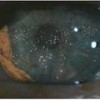 Eyeball Eyeball